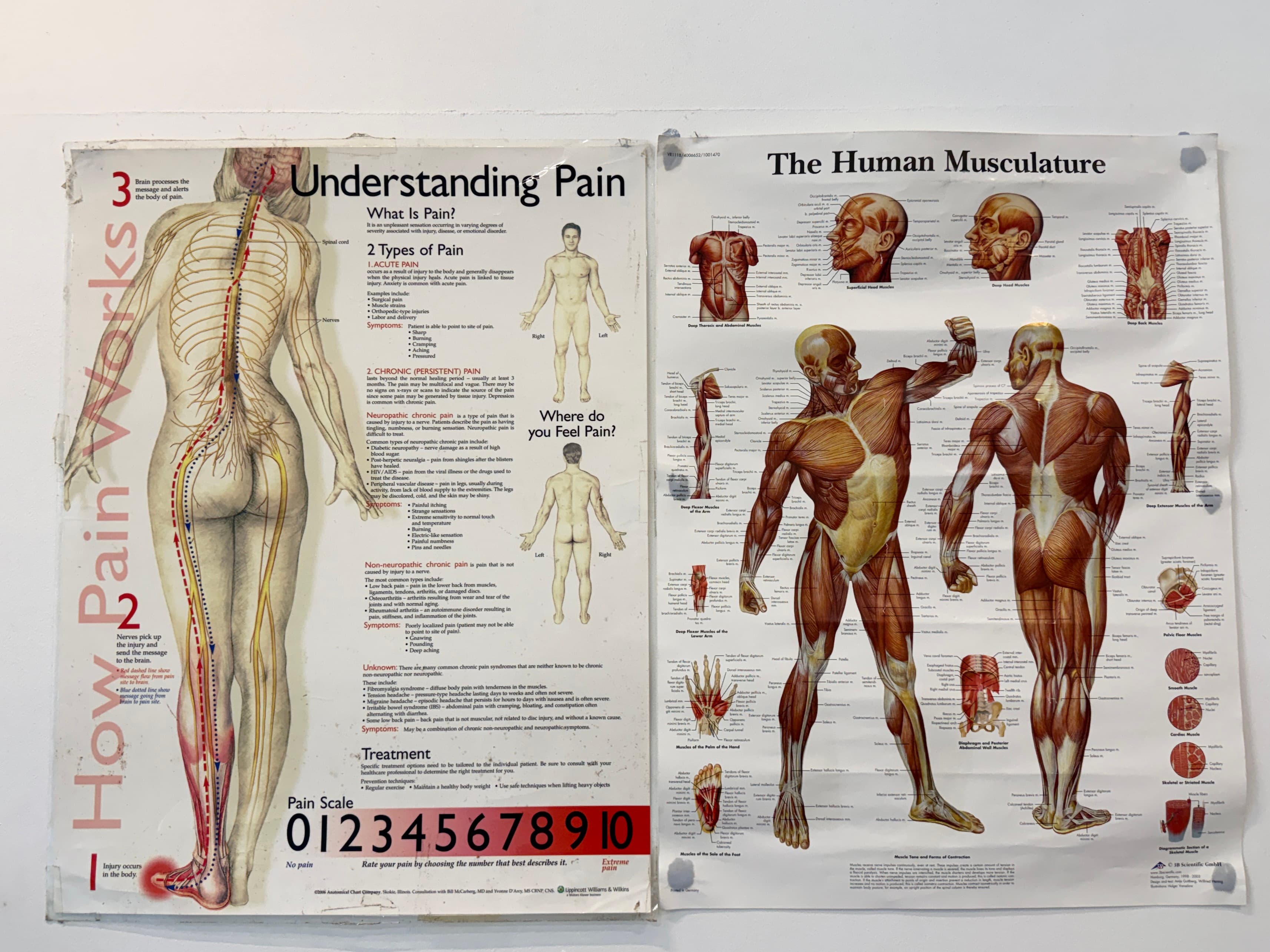 Understanding pain educational chart at SportsRelief Therapy